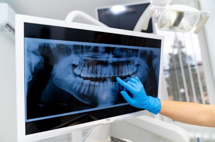 xray